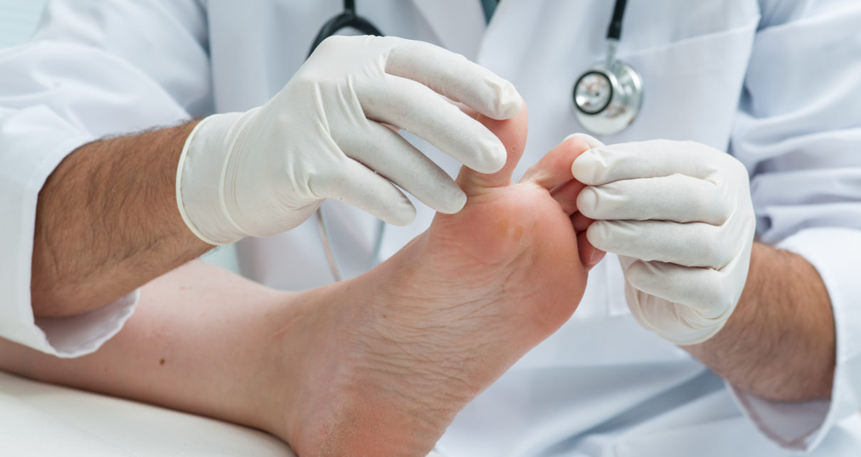 Rola okresowych i przesiewowych badań stóp w profilaktyce zespołu stopy cukrzycowej