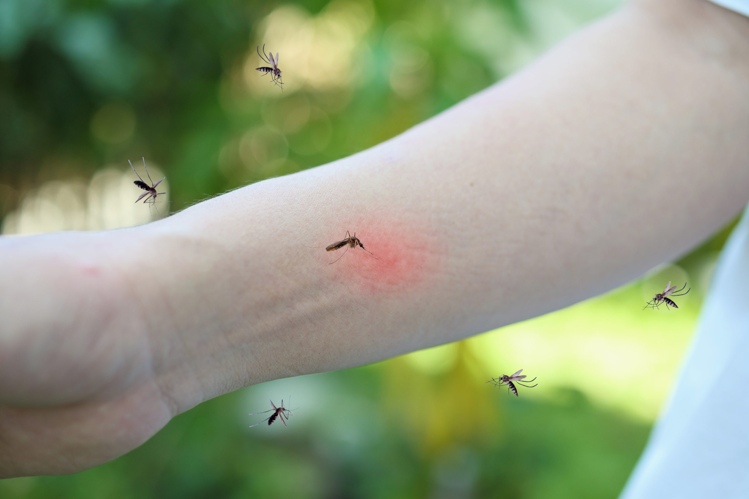Bąble po komarach. Jak się ich pozbyć?