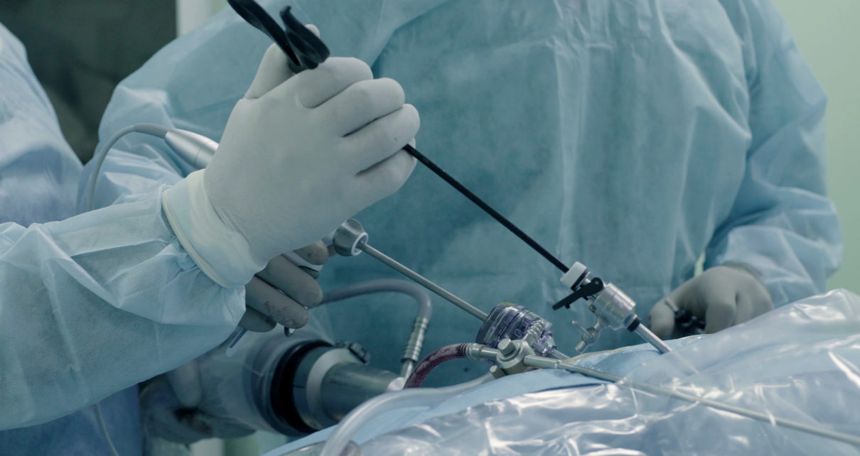 Laparoscopic surgery of the abdomen. The team of medical specialists conducting laparoscopic surgery