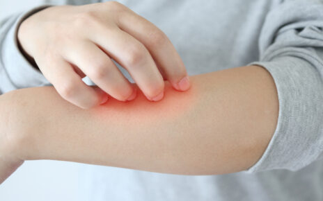 Jak objawia się i jak leczyć kontaktowe zapalenie skóry?