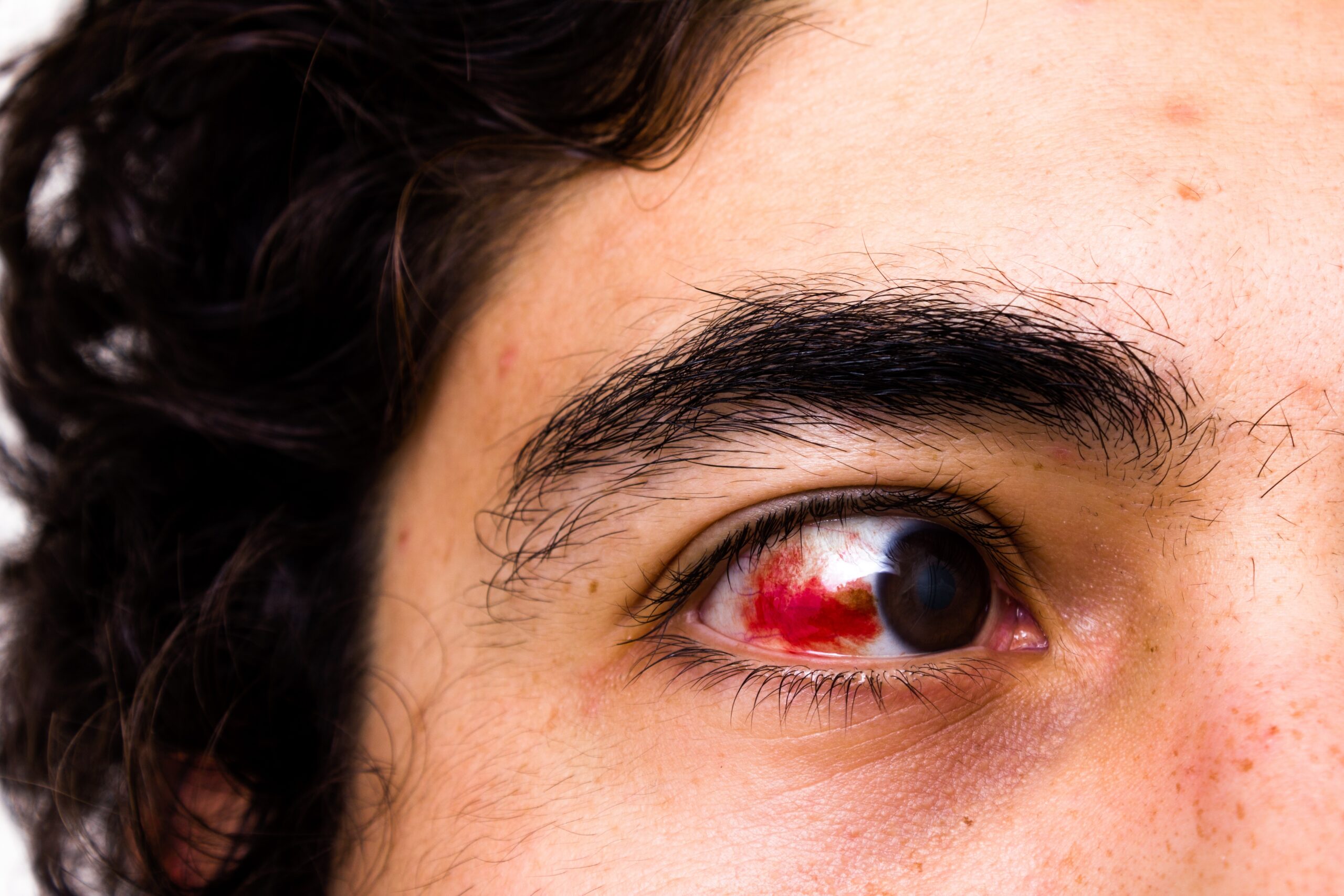 Mechaniczne uszkodzenie oka. Jak zdiagnozować uraz i jakie badania należy przeprowadzić?