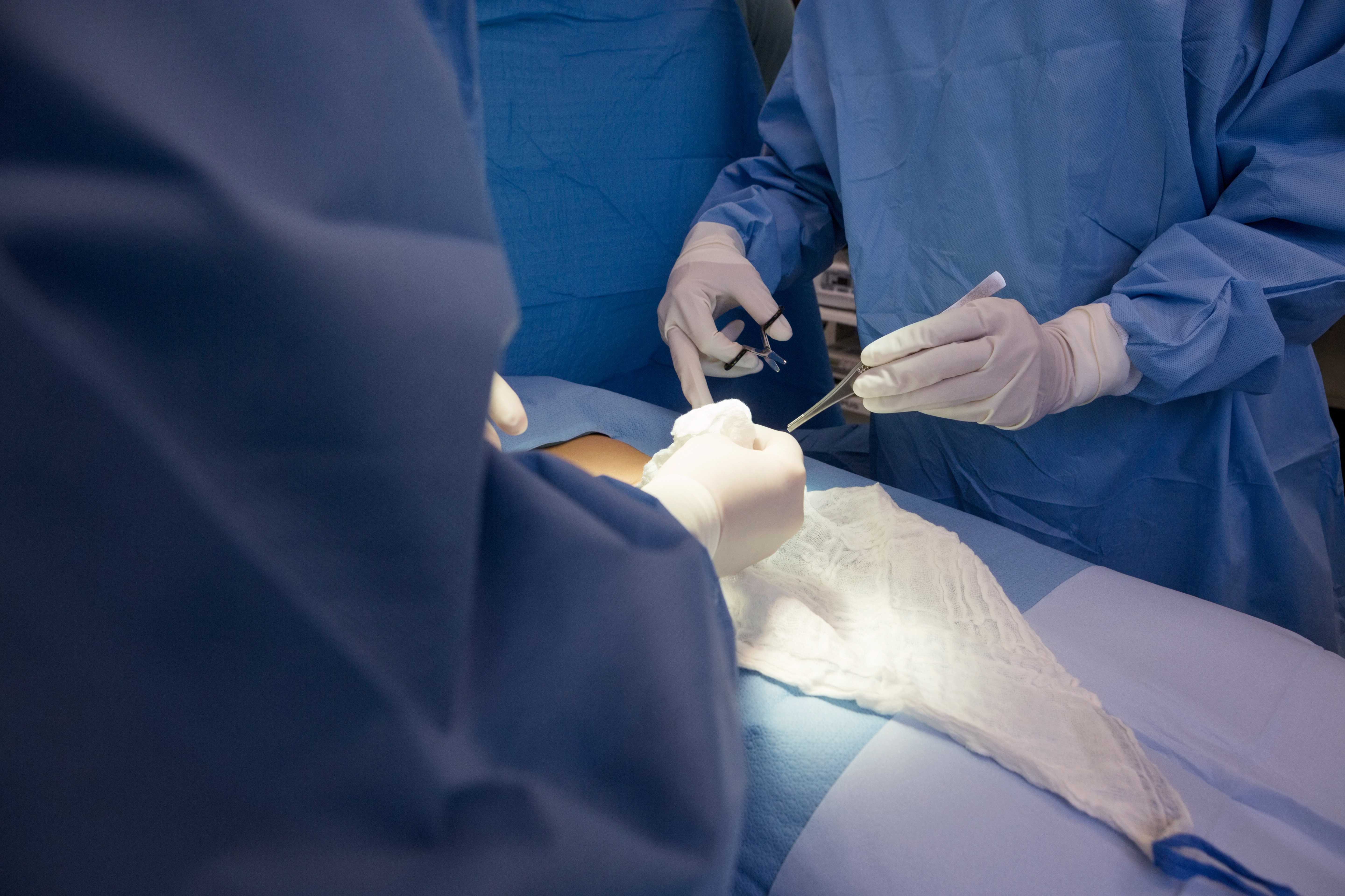 Operacja stawu biodrowego z wykorzystaniem spersonalizowanego implantu